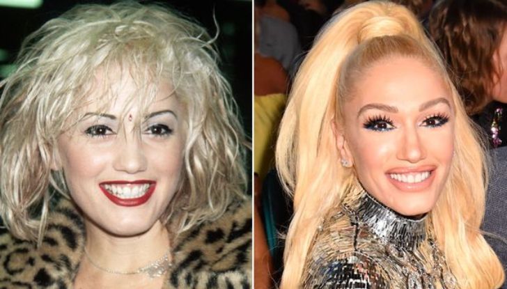 Gwen Stefani's Plastic Surgery: Learn all the Details Here